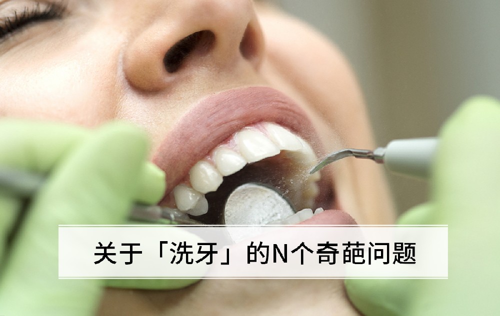 关于「洗牙」的N个奇葩问题